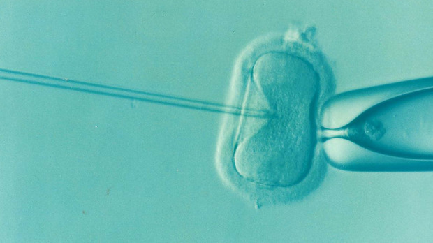 A microscope view of an IVF treatment inserting sperm into the egg